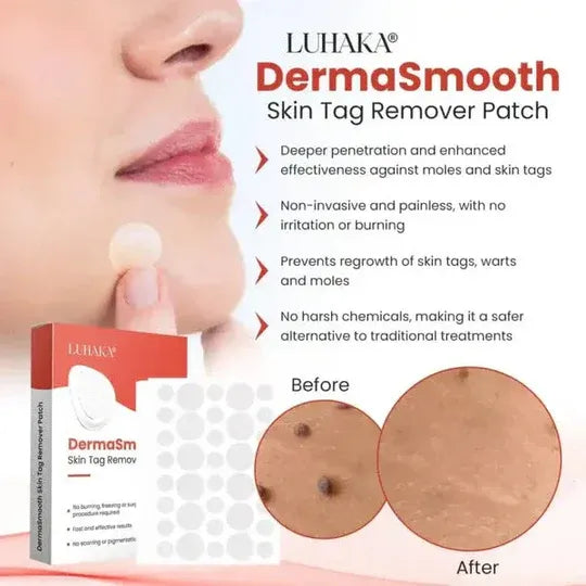 DermaSmooth mole Remover – Safe & Painless Removal